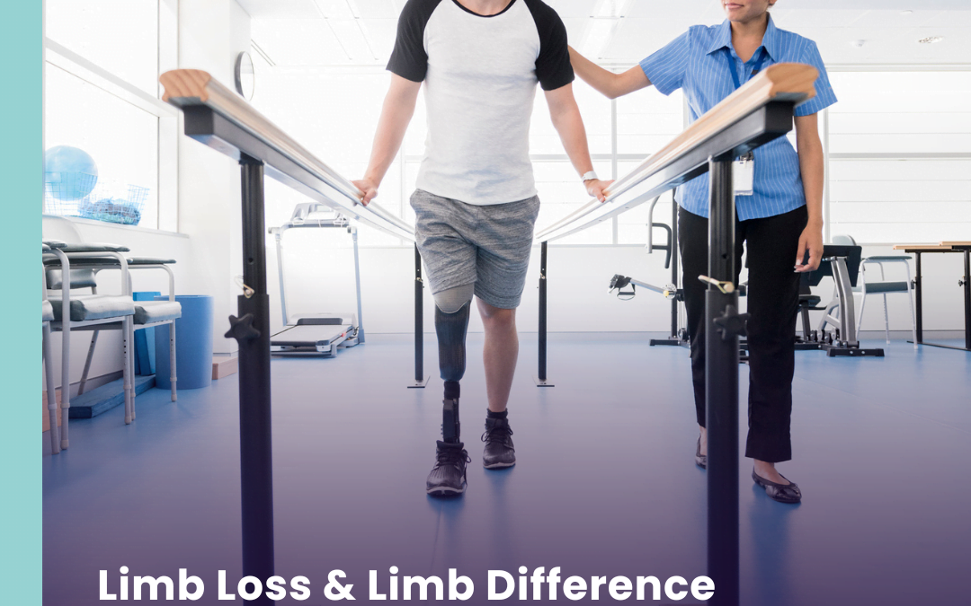 Q&A with Jason Chidwick, HCML Clinical Lead for Amputee Services